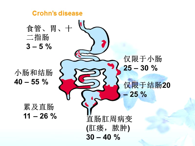 《克罗恩病的护理》PPT课件.ppt_第3页