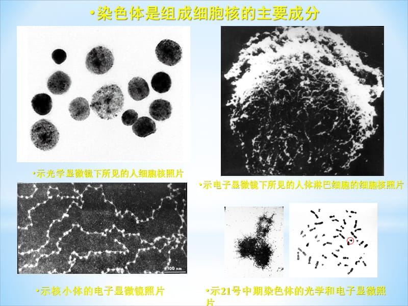 染色体病-1_第3页