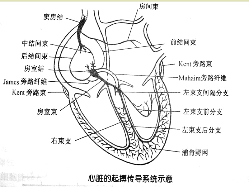 病窦综合征的护理.ppt_第3页