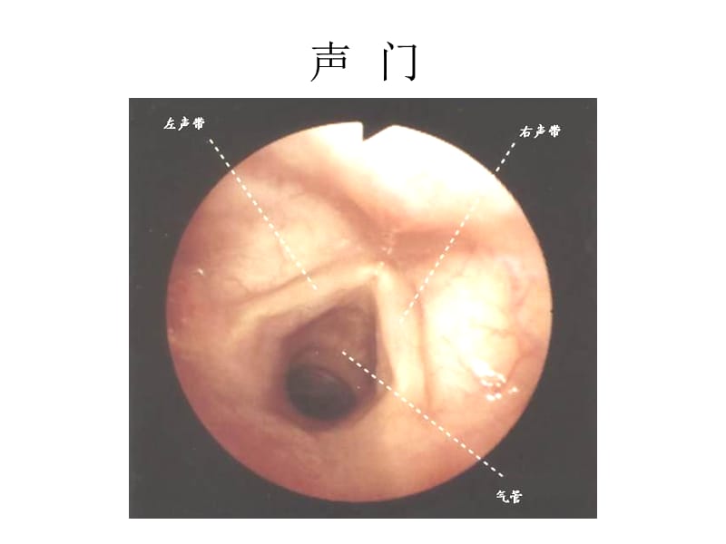 纤维支气管镜解剖.ppt_第3页