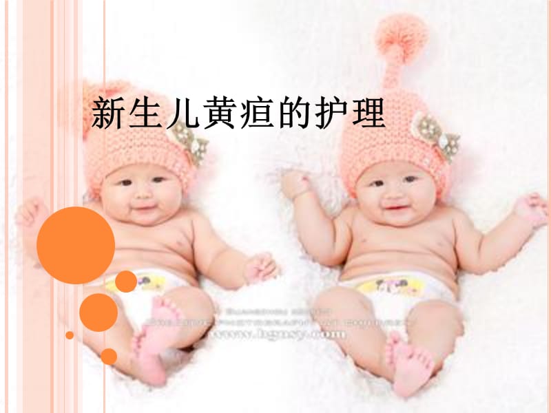 新生儿黄疸的护理.ppt_第1页