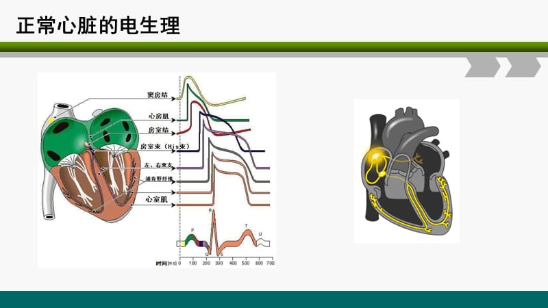 除颤的原理及使用.ppt_第3页