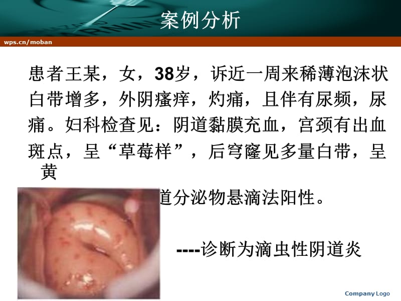 阴道炎患者的健康教育.ppt_第2页