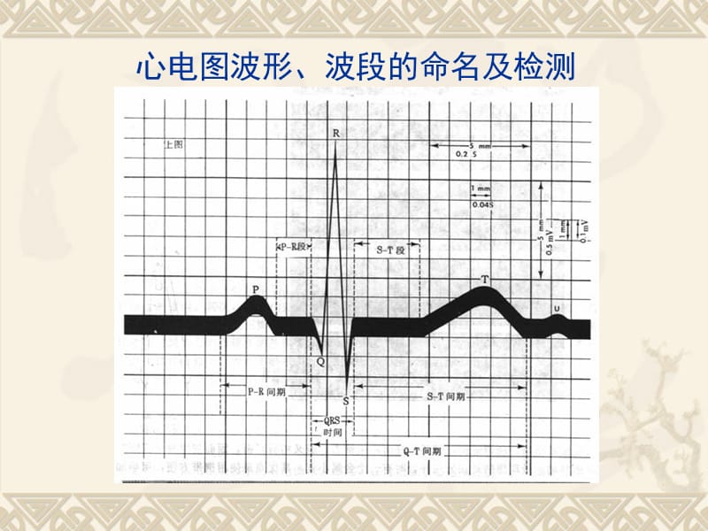 《快速分析心电图》PPT课件.ppt_第3页