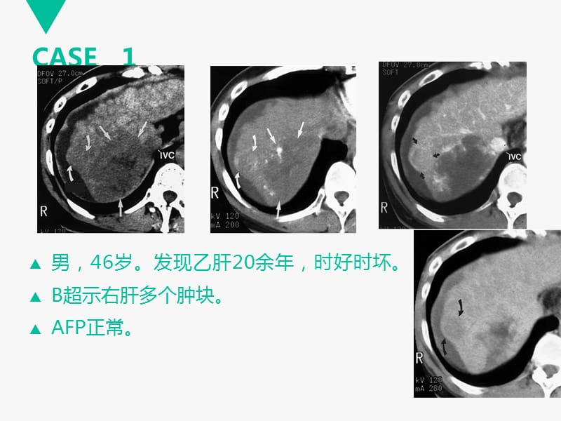 临床思维和技能训练-腹部病变影像鉴别诊断_第2页