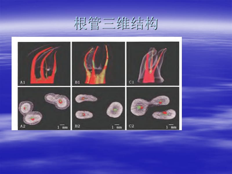 《根管冲洗与消毒》PPT课件.ppt_第2页