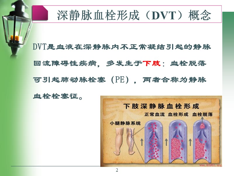 深静脉静脉血栓预防及护理ppt课件_第2页