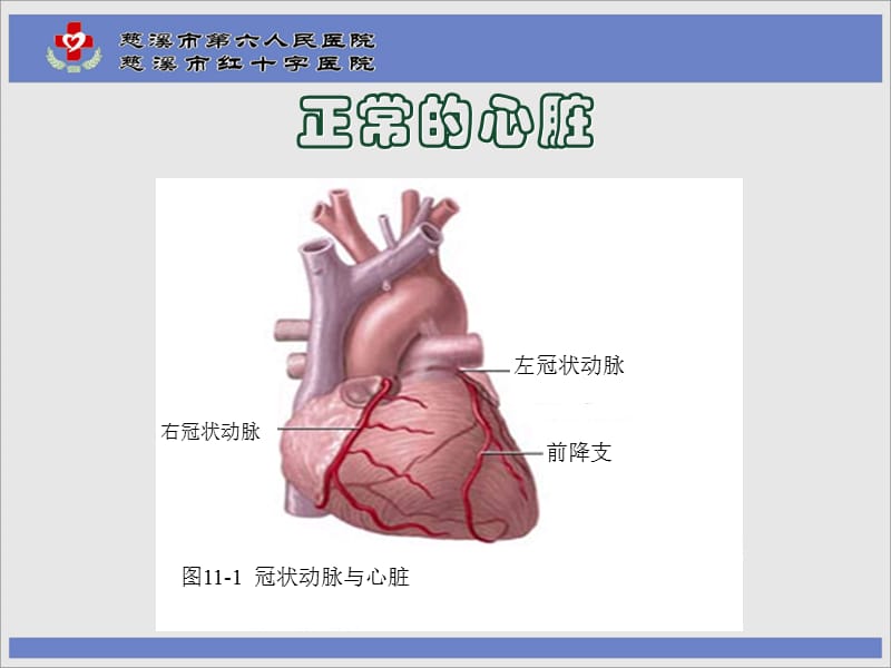 《冠心病护理要点》PPT课件.ppt_第2页