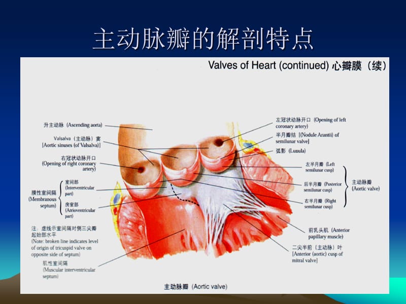 《主动脉瓣疾病》PPT课件.ppt_第3页