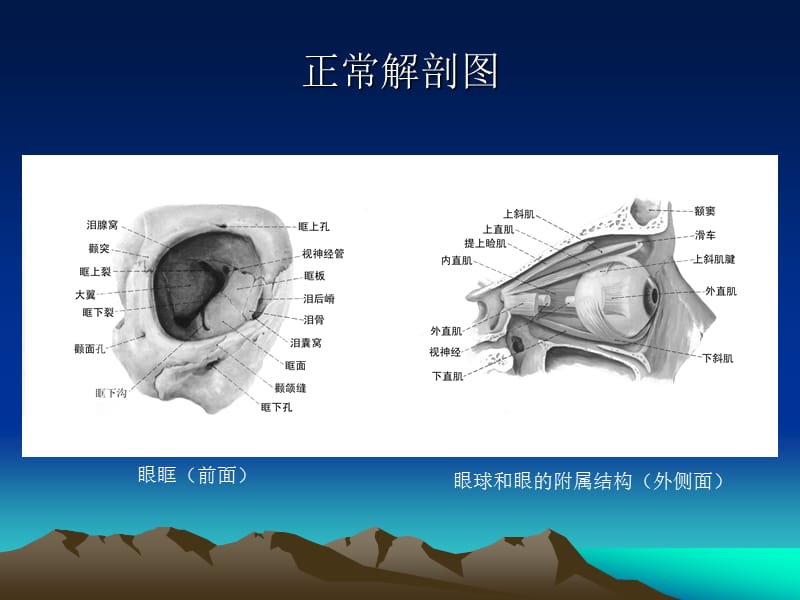 眼和眼眶的影像学诊断.ppt_第3页