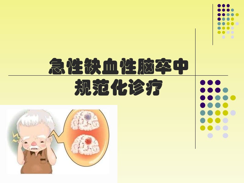 急性缺血性脑卒中.ppt_第1页