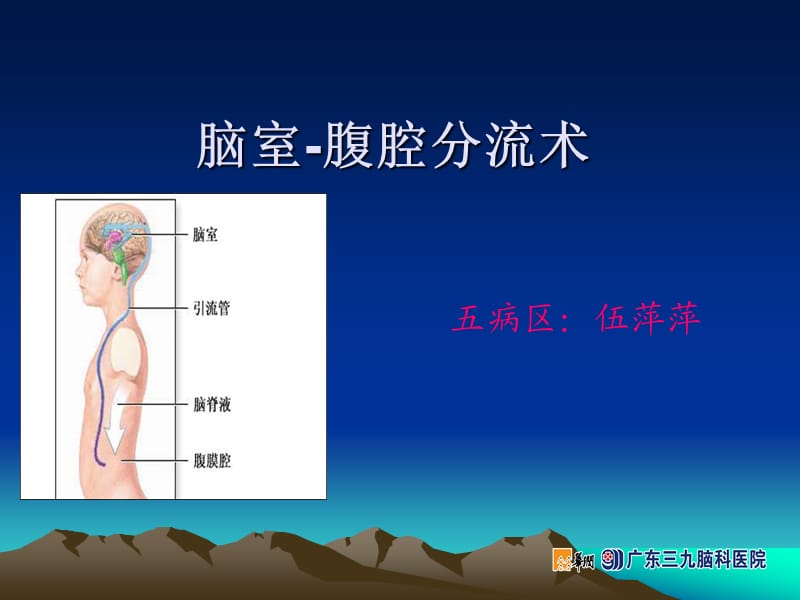 脑室-腹腔分流术.ppt_第1页