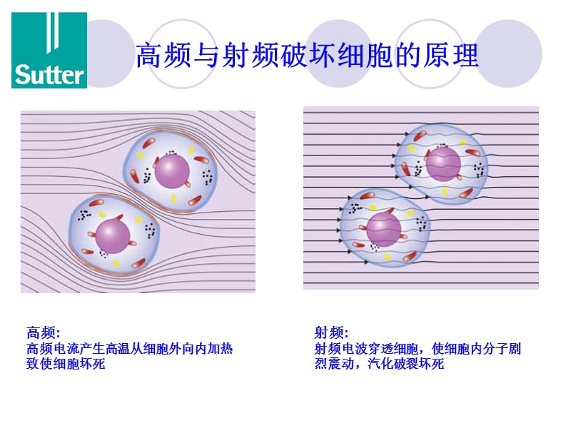 Sutter低温射频刀介绍.ppt_第3页