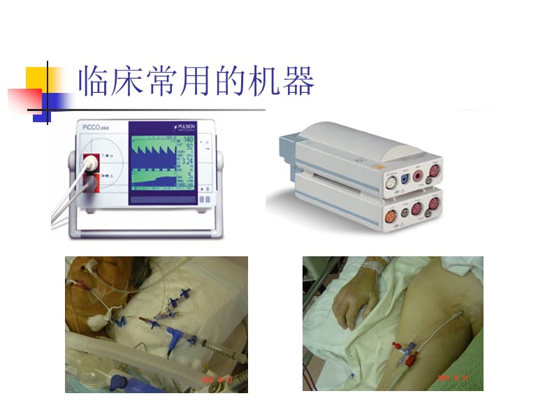 PICCO技术在ICU的应用和护理.ppt_第2页