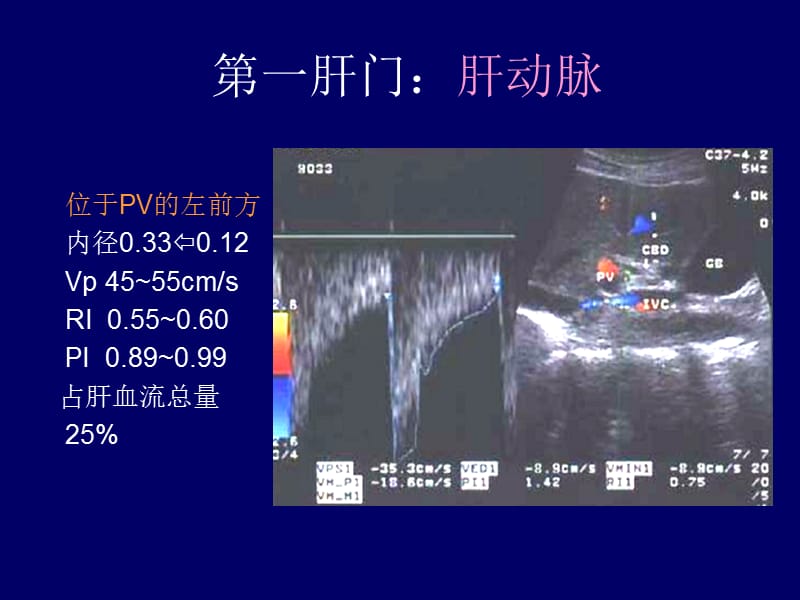 影像-B超-图谱-肝胆超声诊断学.ppt_第2页