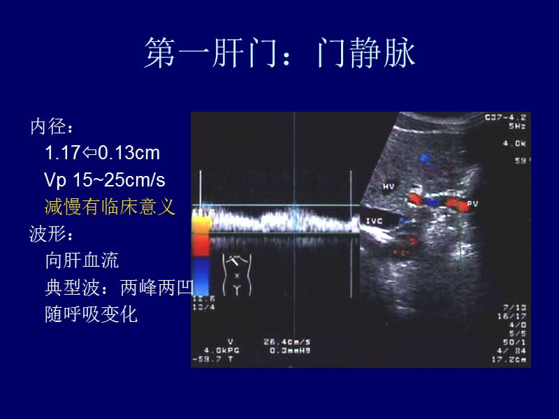 影像-B超-图谱-肝胆超声诊断学.ppt_第3页