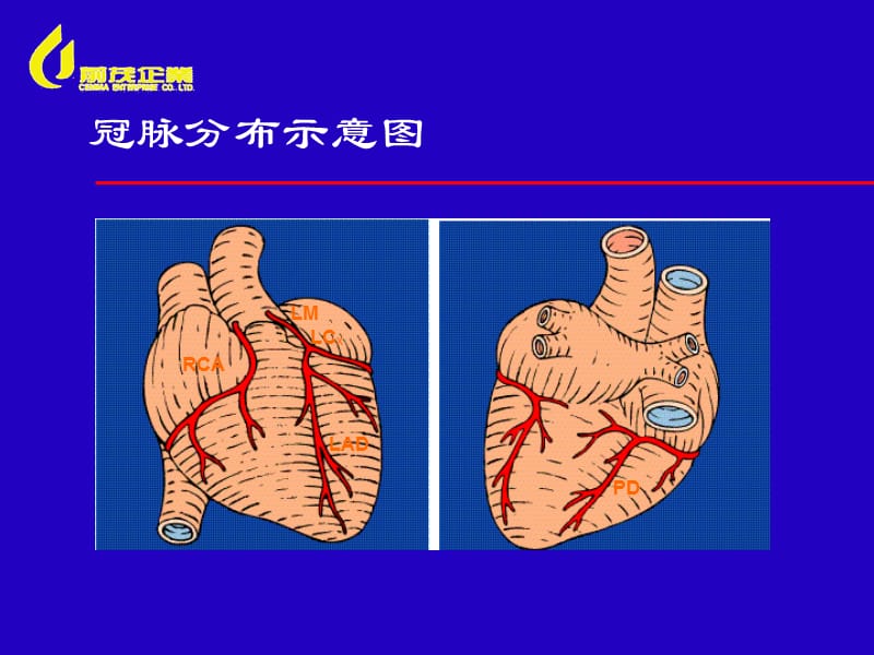 IABP主动脉内球囊反搏经典.ppt_第2页