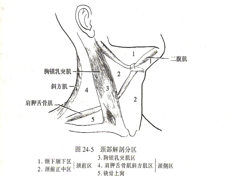 颈部肿块的诊断和鉴别诊断.ppt_第3页