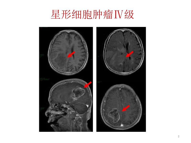 神经教学ppt课件_第2页