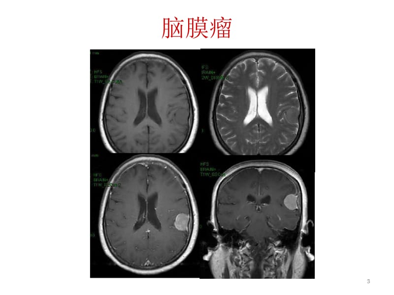 神经教学ppt课件_第3页