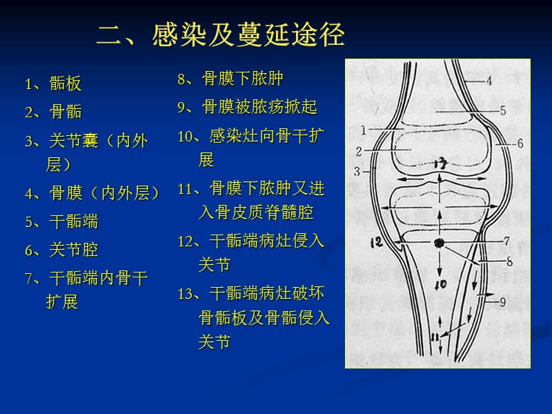 骨髓炎的影像诊断.ppt_第3页