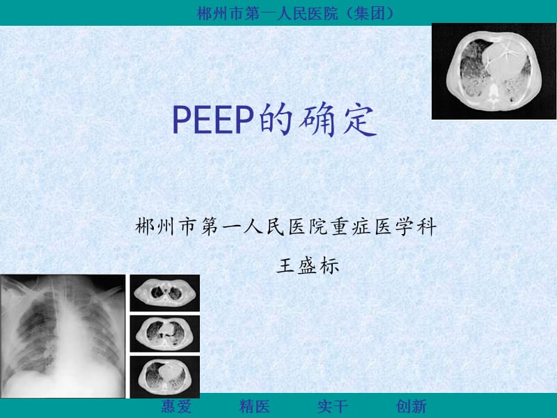 《PEEP的滴定》PPT课件.ppt_第1页