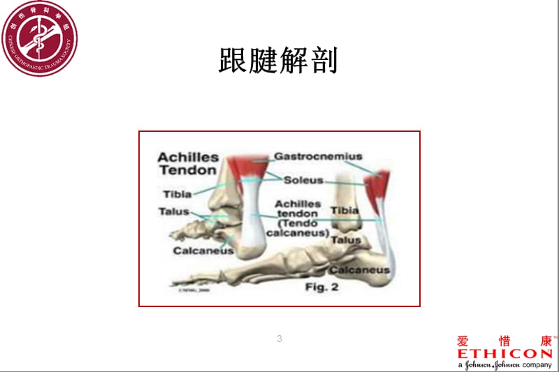 跟腱断裂术后康复流程图.ppt_第3页