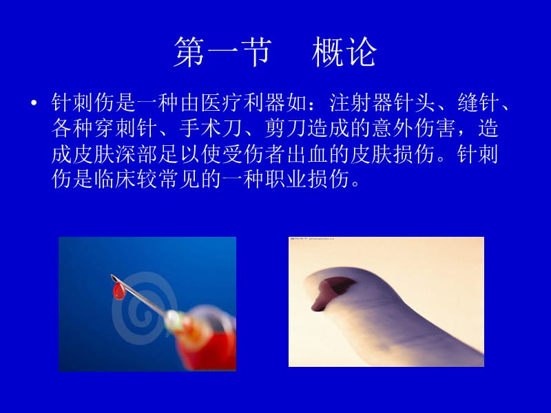 《护理针刺伤PDCA》PPT课件.ppt_第3页