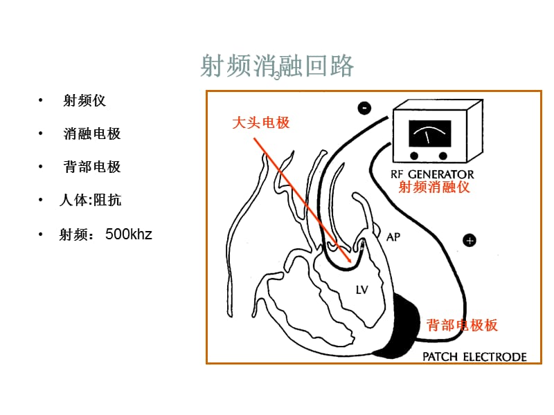 射频消融原理ppt课件_第3页