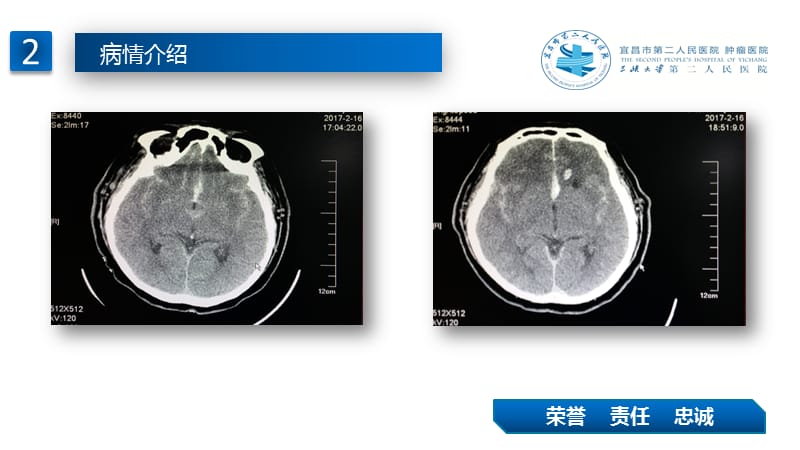 镇痛镇静在神经外科患者的应用.ppt_第3页