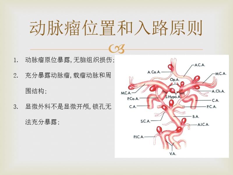 颅内动脉瘤手术入路_第2页