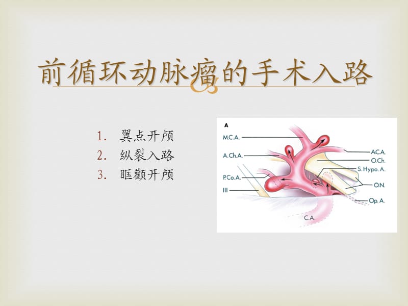 颅内动脉瘤手术入路_第3页