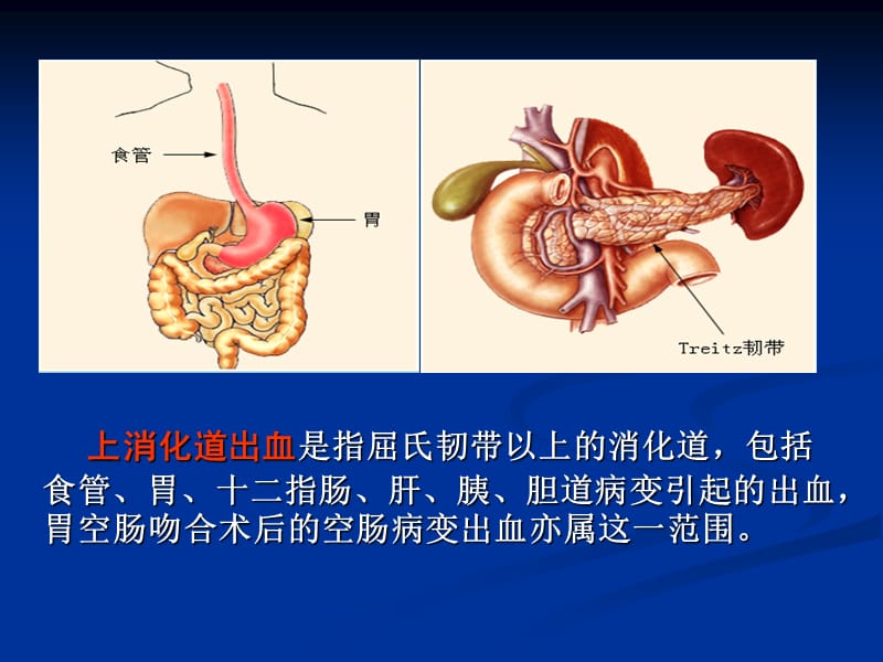 消化道出血护理查房(带病例).ppt_第3页