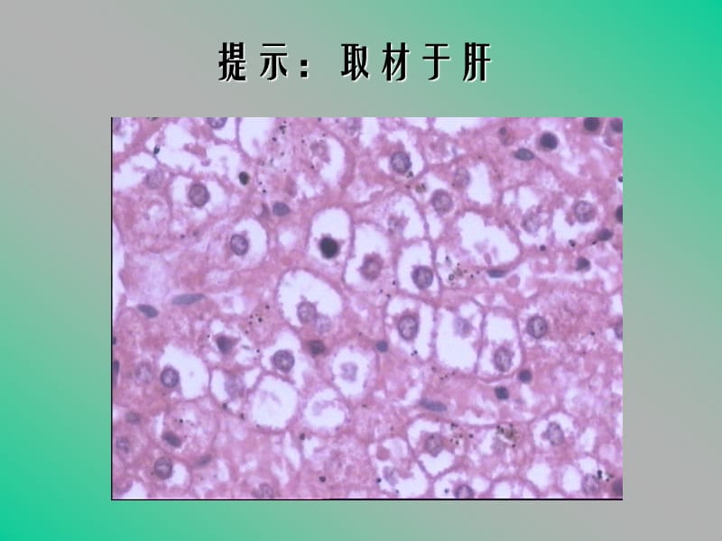 温州医学院病理学实验考试.ppt_第2页