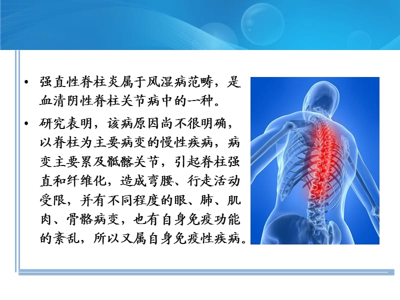 强直性脊柱炎的诊断与治疗.ppt_第2页