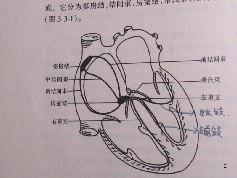 常见心电图诊断ppt课件_第2页