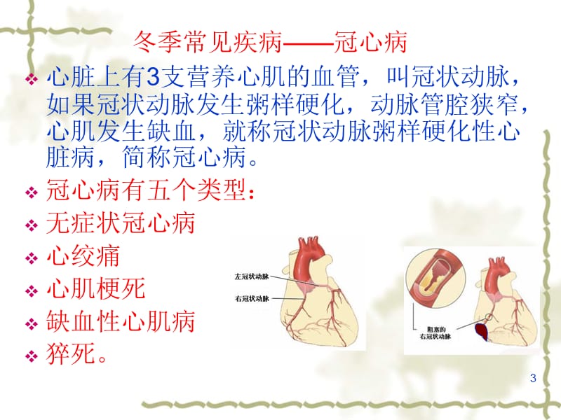 冬季中老年人常见疾病预防及保健ppt课件_第3页