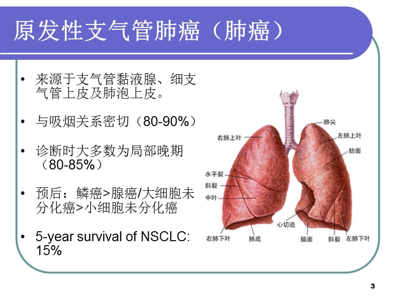 肺癌分期ppt课件_第3页