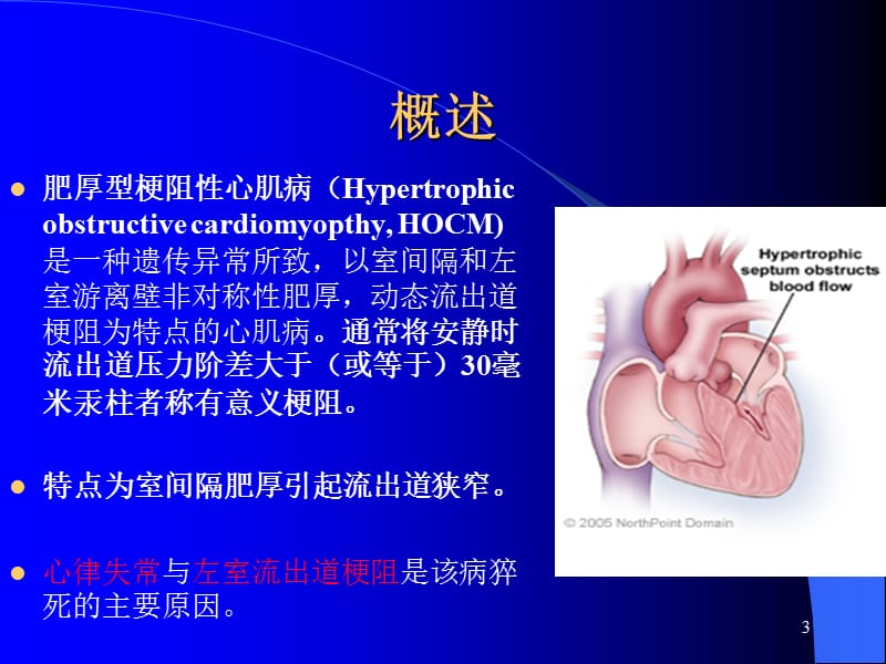 肥厚型梗阻性心肌病人的麻醉ppt课件_第3页