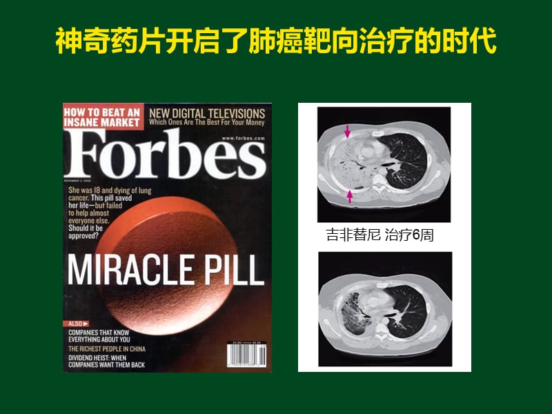 肺癌靶向治疗的策略及临床实践ppt课件_第2页