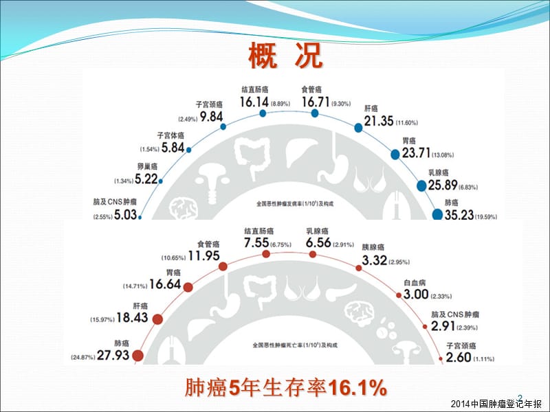 肺癌分子靶向药物治疗病例分享ppt课件_第2页