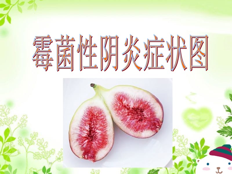 《霉菌性阴炎症状》PPT课件.ppt_第1页