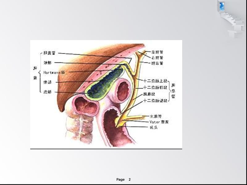 肝内外胆管结石护理查房ppt课件_第2页