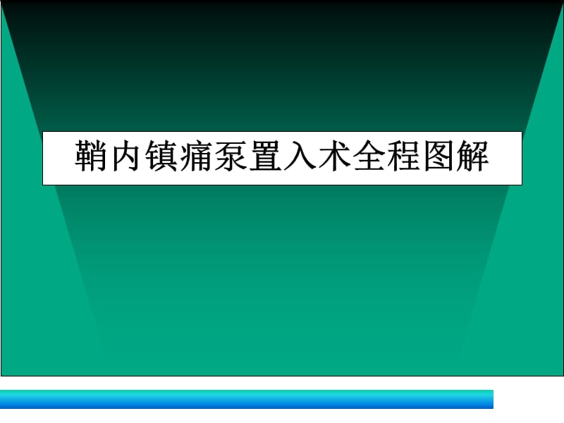 爱爱医资源-鞘内镇痛泵置入术全程图解.ppt_第1页