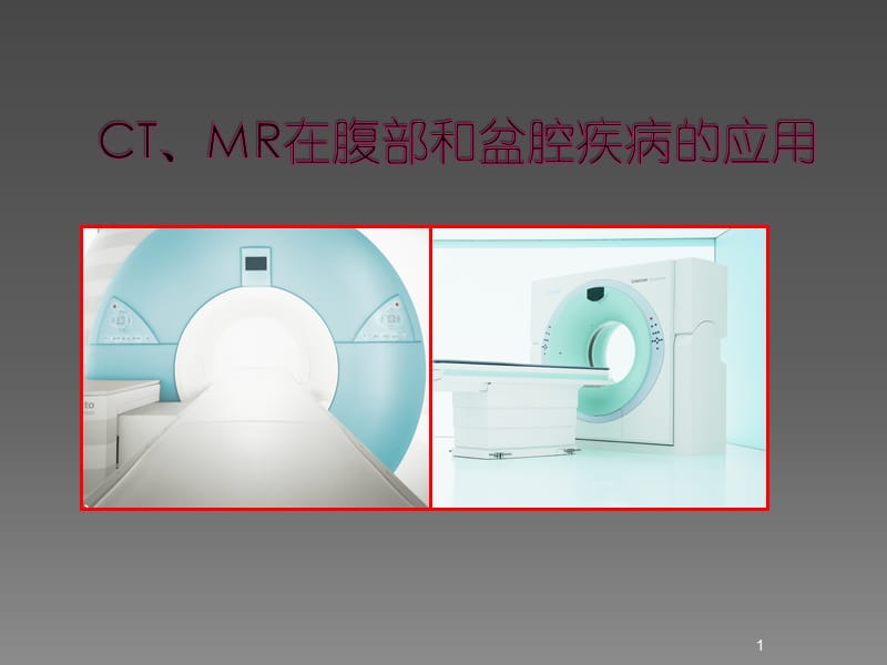 腹部盆腔CTMR诊断ppt课件_第1页