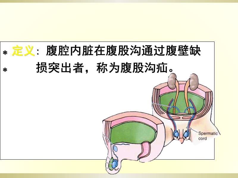 腹腔镜小儿腹股沟疝ppt课件_第2页