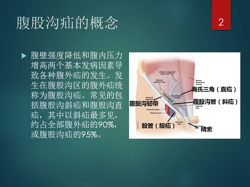 腹股沟疝的诊断与治疗ppt课件_第2页