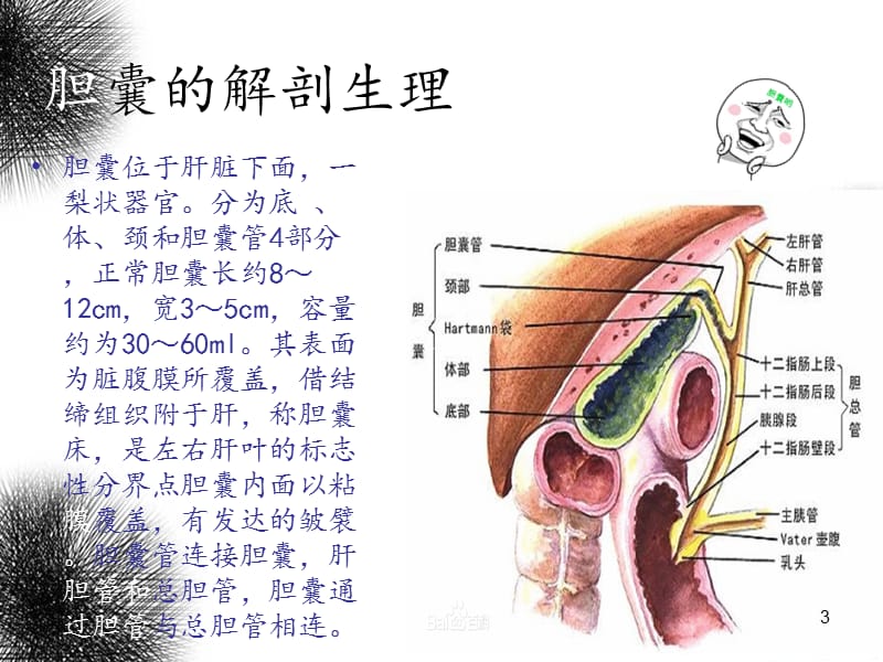 腹腔镜胆囊切除手术配合ppt课件_第3页