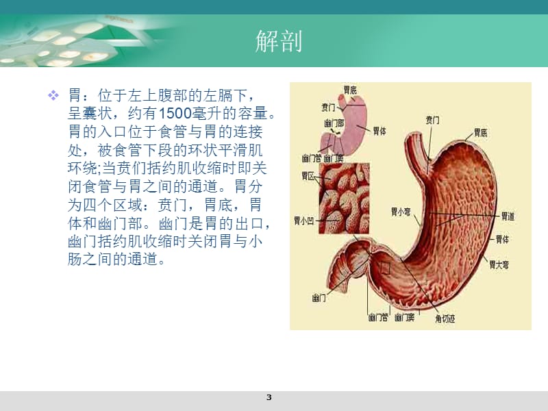 腹腔镜胃癌根治术的手术配合ppt课件_第3页