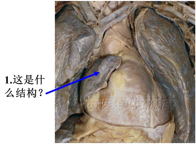 系统解剖标本考试(医学生的必备)免金币.ppt_第2页